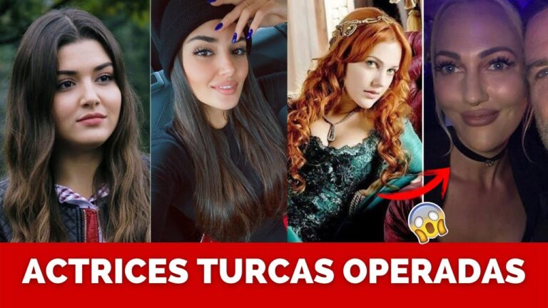 Belleza Turca: ¿Secretos de Cirugía Plástica?