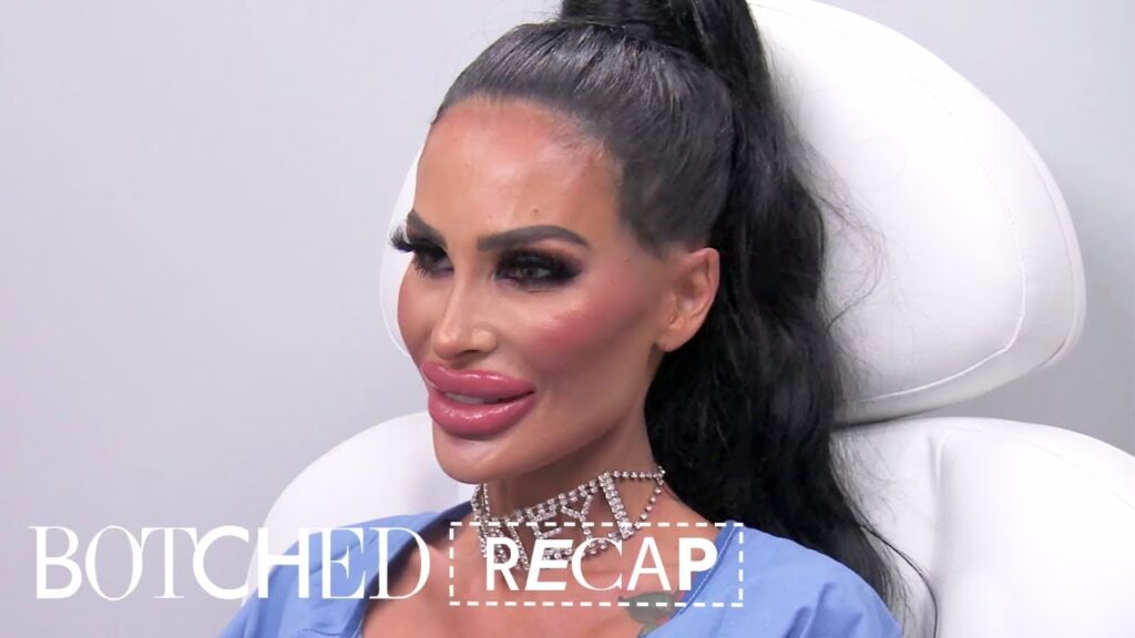 La Barbie Humana: Cirugías, Costos y Riesgos