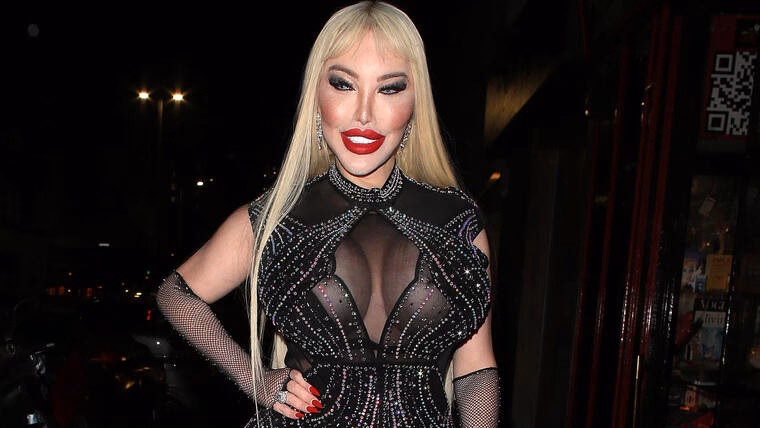 ¿Cuál fue la cirugía que se hizo la Barbie colombiana?