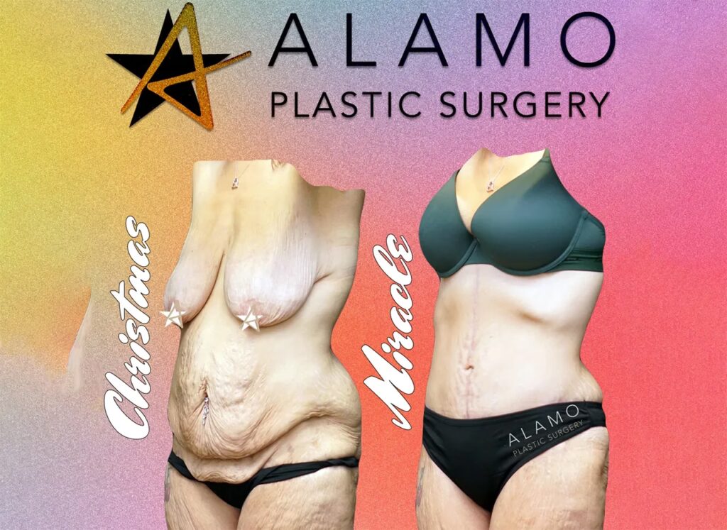 Recuperación de Cirugía Plástica: Guía Completa