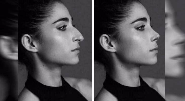 ¿Qué se ha operado Alba Carrillo?