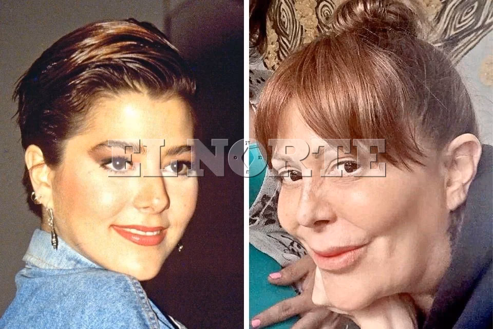 ¿Cuántas prótesis de cadera tiene Alejandra Guzmán?