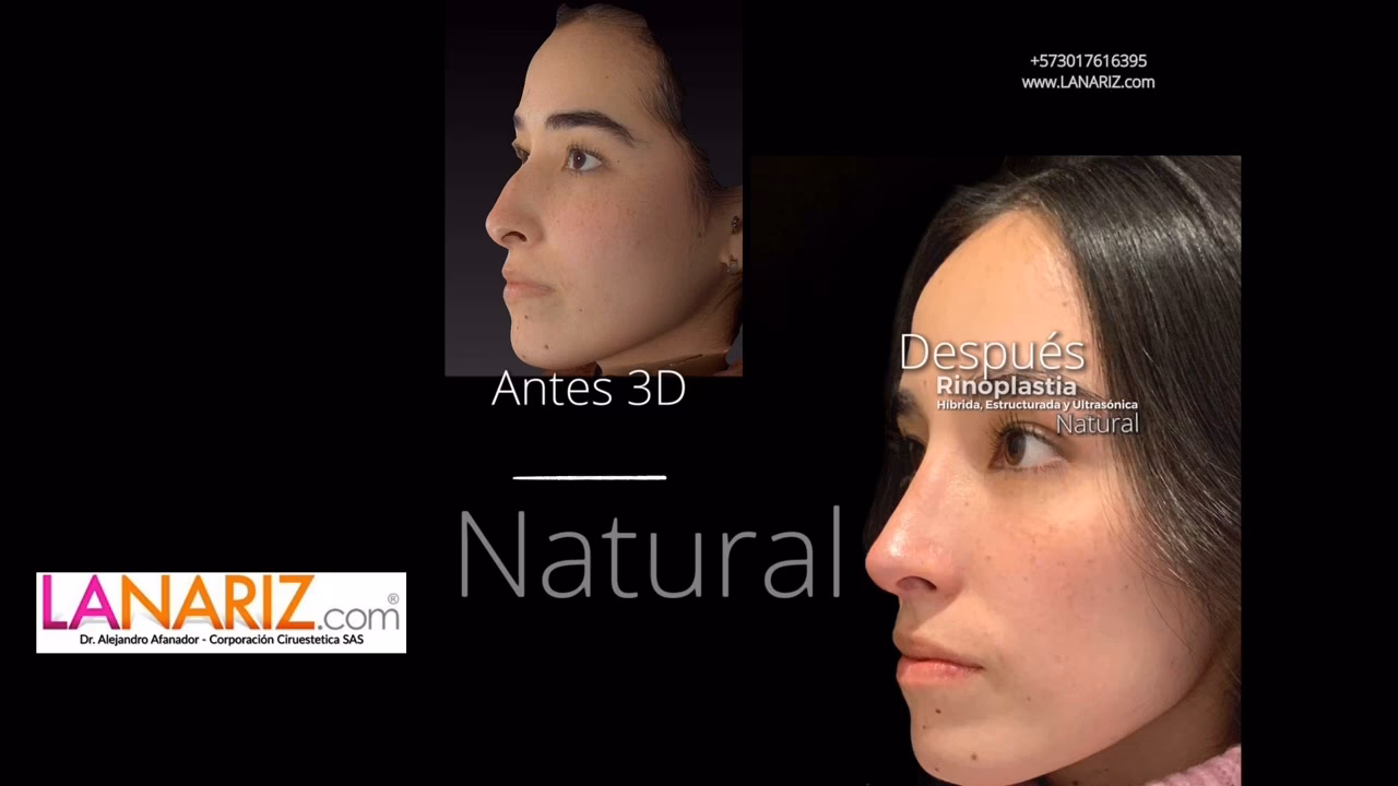 ¿Quién opera mejor la nariz?