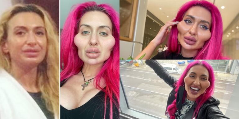 Anestesiólogo: Tu Guardián en Cirugía Plástica