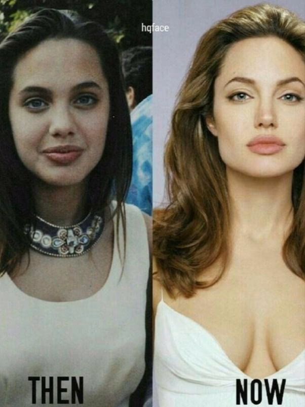 ¿Qué operaciones de estética se ha hecho Angelina Jolie?