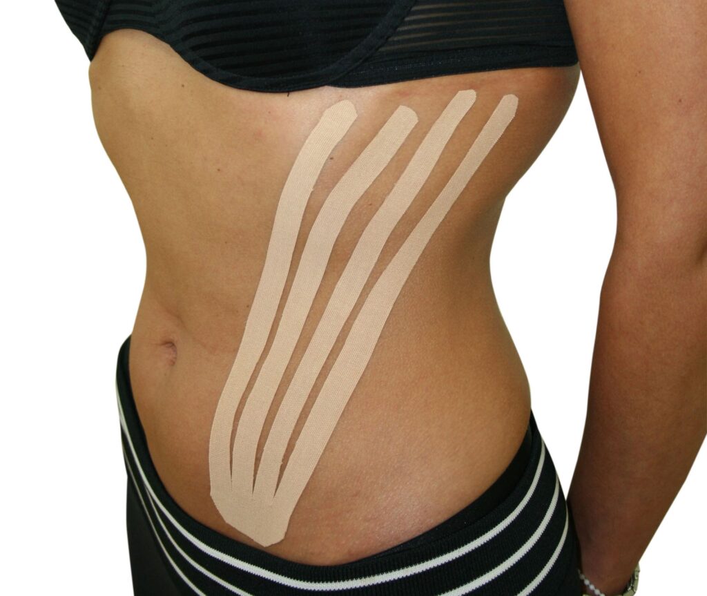 Piel y Liposucción: ¿Cómo lograr la máxima firmeza?