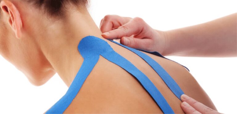 Kinesiotaping Post-Cirugía: Acelera tu Recuperación
