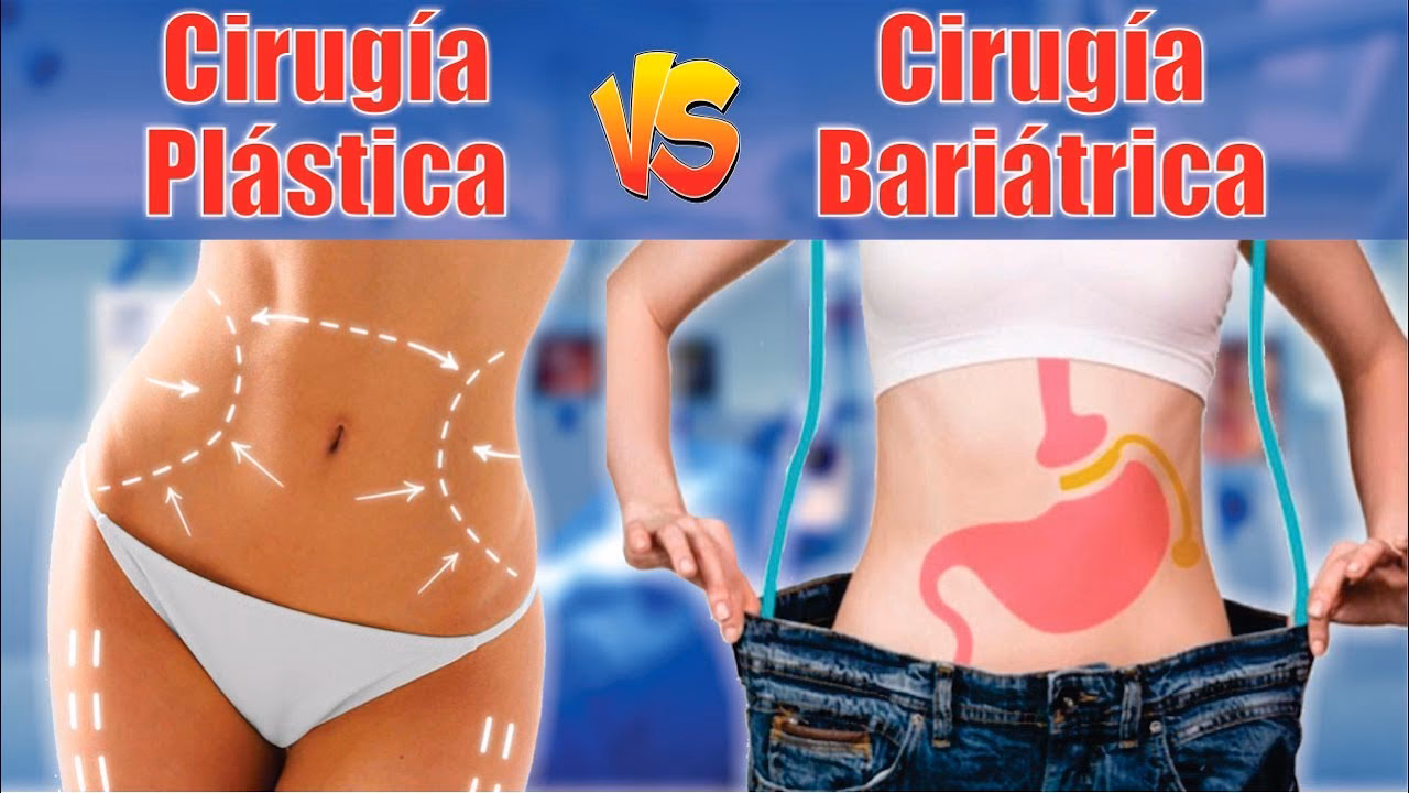 ¿Cuál es la cirugía plástica más popular en Corea?