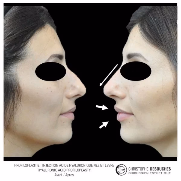 ¿Cómo se recupera la piel después de una cirugía plástica?