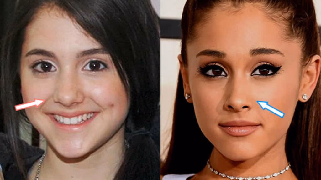 ¿Qué cirugías se hizo Ariana Grande?