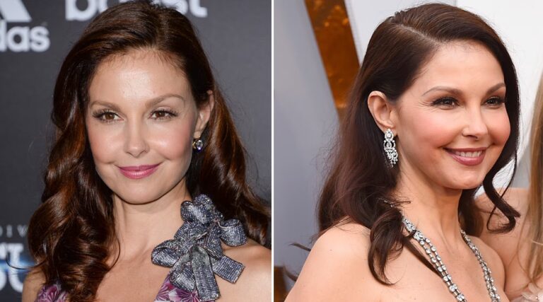 El Rostro de Ashley Judd: ¿Cirugía o Enfermedad?