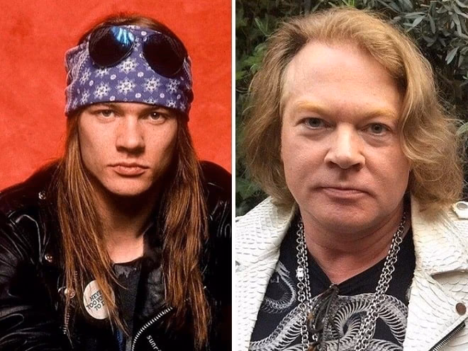 Axl Rose: ¿El Secreto de su Eterna Juventud?