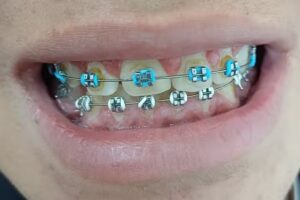 BARTRA CROVI – Clínica de Salud y Estética Dental