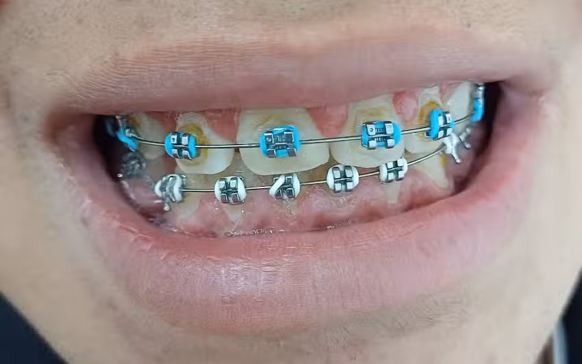 BARTRA CROVI – Clínica de Salud y Estética Dental