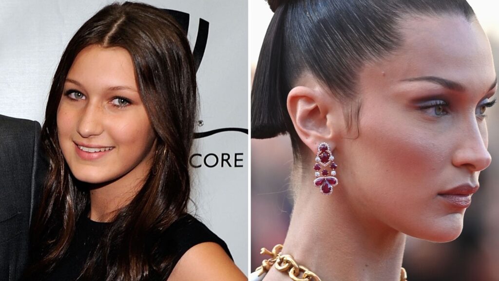 Las Cirugías Plásticas de Bella Hadid al Descubierto