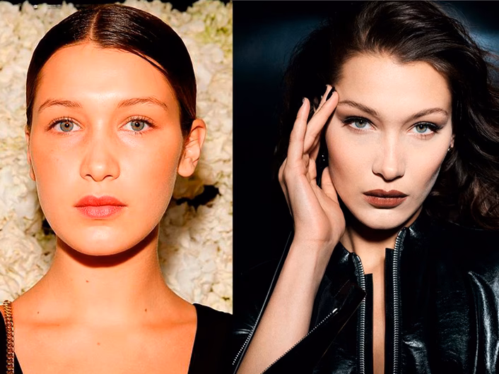 ¿Qué cirugías tiene Bella Hadid?