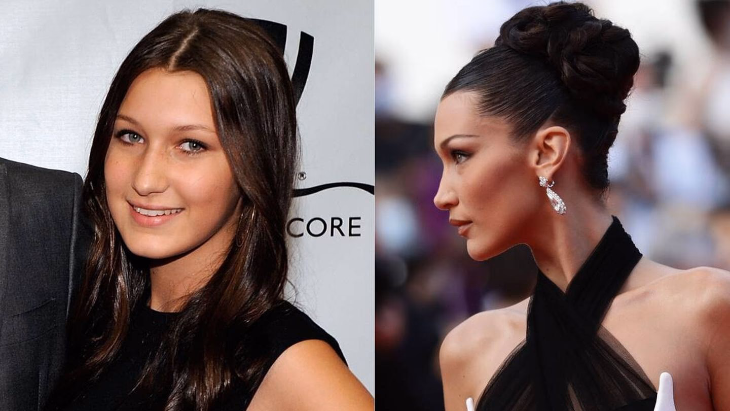 ¿Qué operaciones tiene Gigi Hadid?