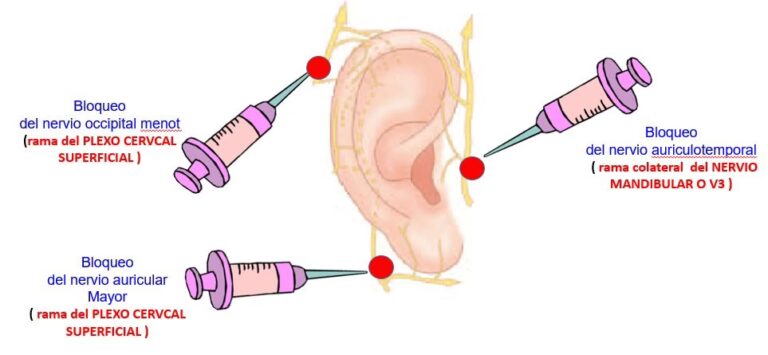 Guía Completa sobre la Reconstrucción de Oreja