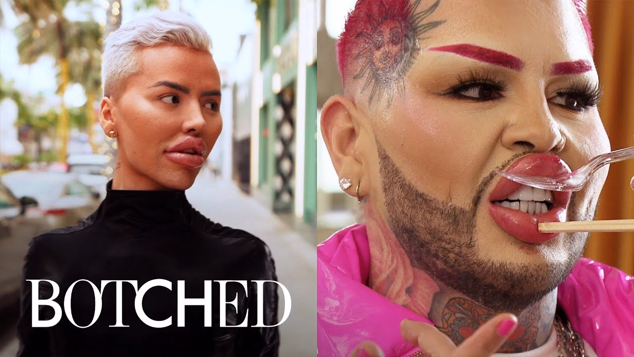 ¿Quién paga las cirugías en Botched?