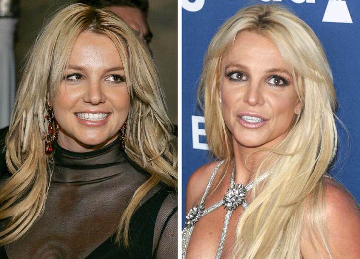 ¿Qué tiene diagnosticado Britney Spears?