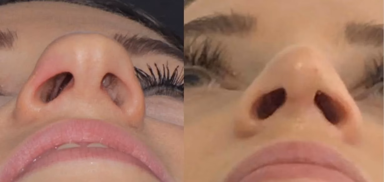 ¿Cuál es la cirugía estética más difícil?