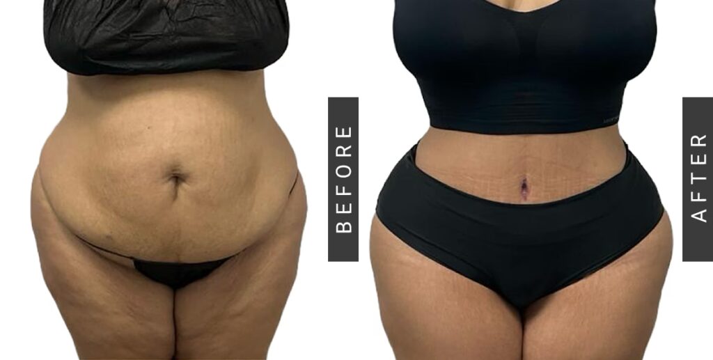 Unión Personal: ¿Buena Obra Social o Decepción?