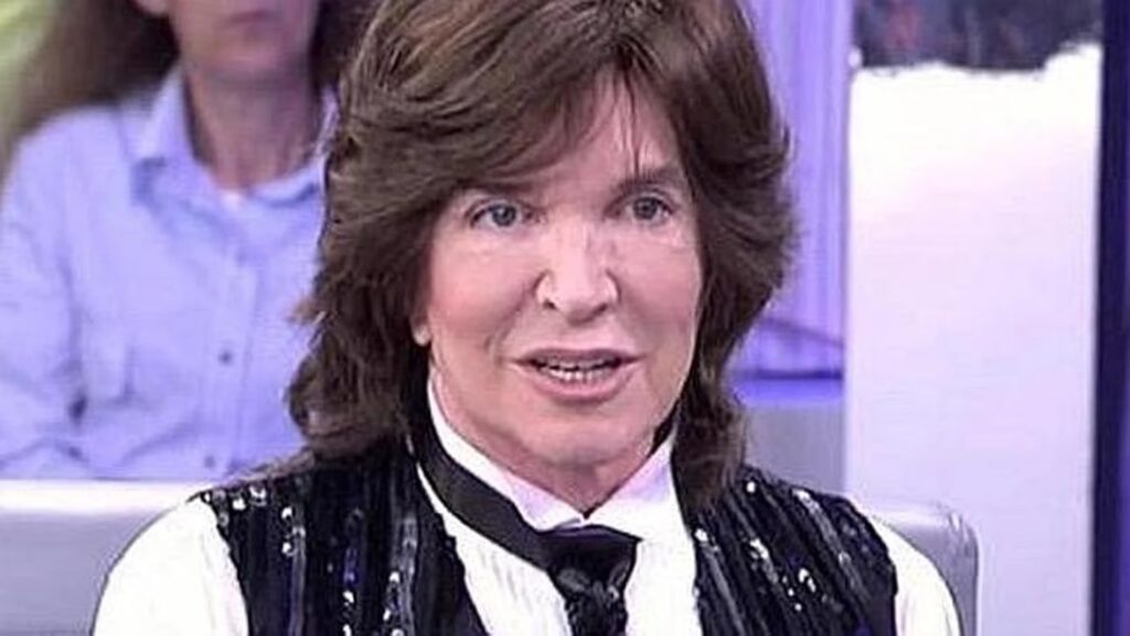 Camilo Sesto: Las Cirugías del Ícono Musical