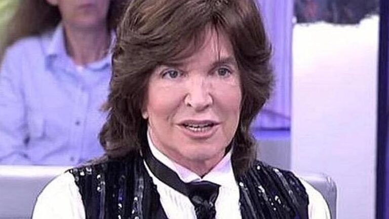 Camilo Sesto: Las Cirugías del Ícono Musical