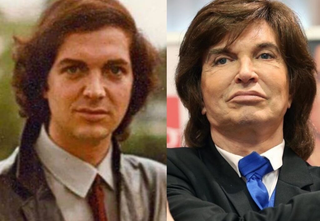 Asimetría Facial: Causas, Riesgos y Soluciones