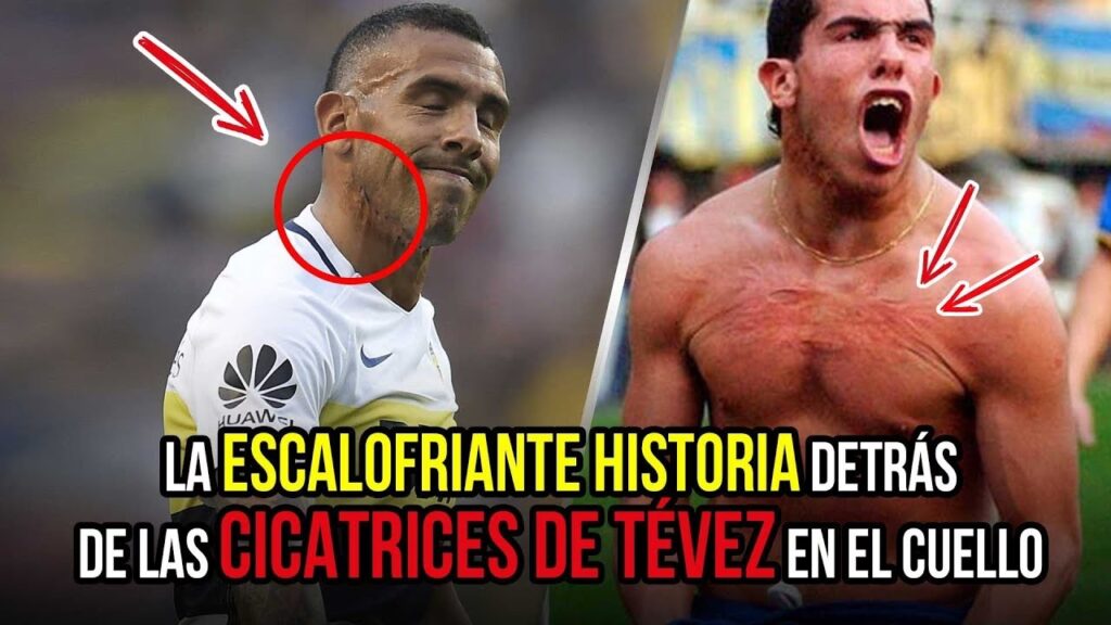 Carlos Tévez: La Historia Detrás de sus Cicatrices