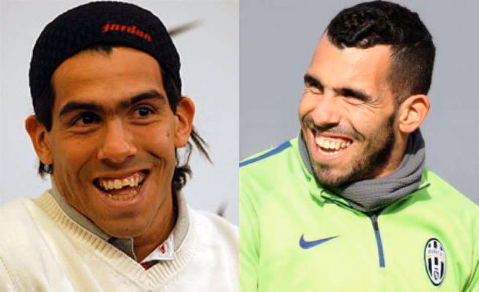 ¿Cómo obtuvo Tévez sus cicatrices?