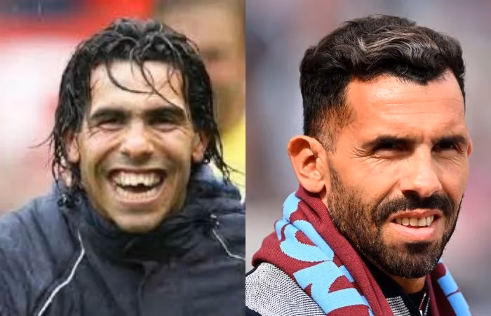 ¿Qué le pasó a Carlos Tévez en el ojo?