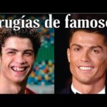 Famosas con Abdominoplastia: ¿Quiénes la tienen?