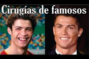 Famosas con Abdominoplastia: ¿Quiénes la tienen?