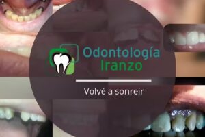 Centro Iranzo Salud Dental y Estética Facial