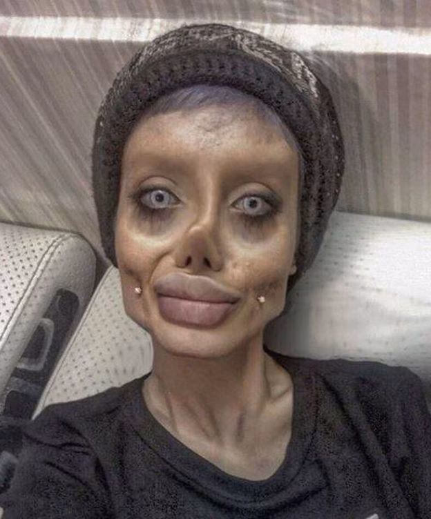 ¿Quién se sometió a cirugía para parecerse a Angelina Jolie?