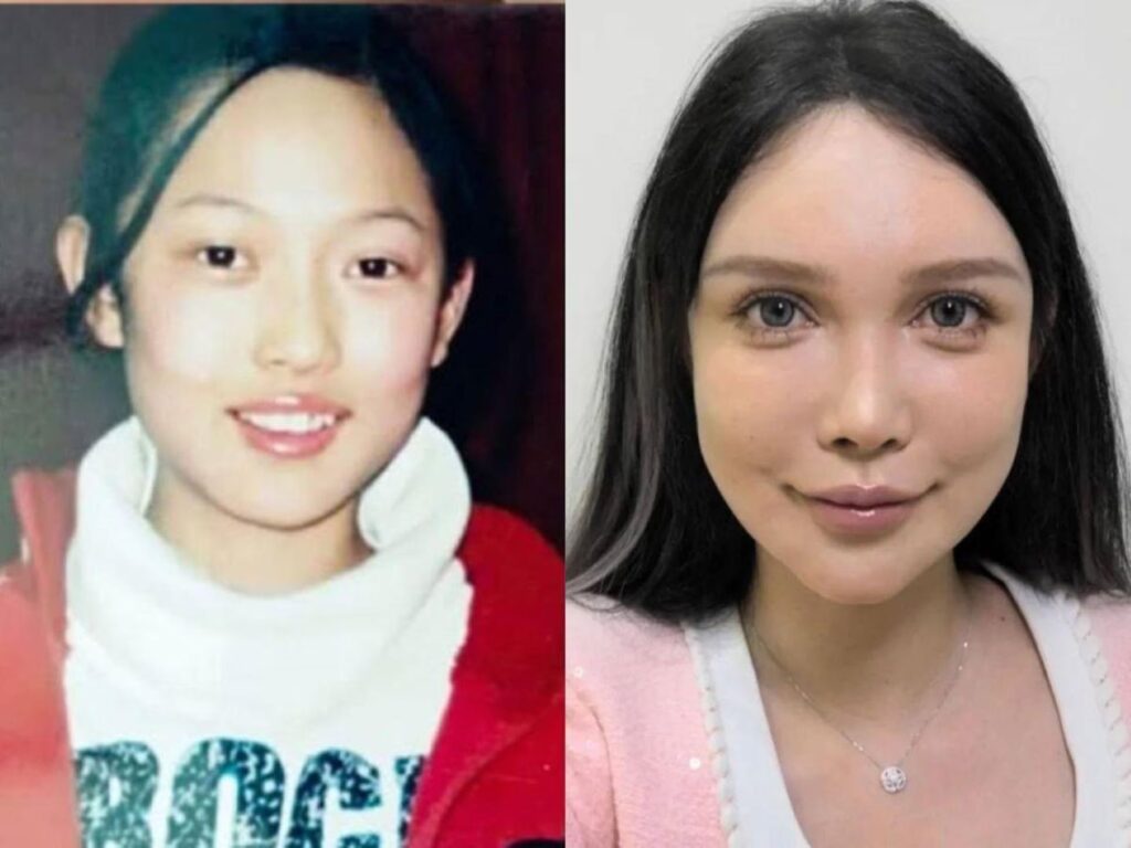 Cirugía Plástica en China: Guía Completa de Precios