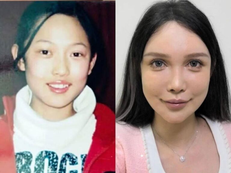 Cirugía Plástica en China: Guía Completa de Precios