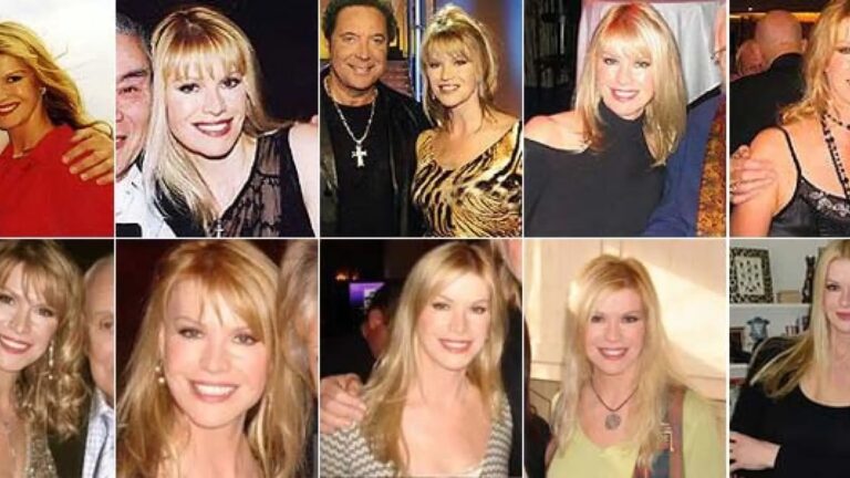 La Mini Abdominoplastia de La Toxi Costeña