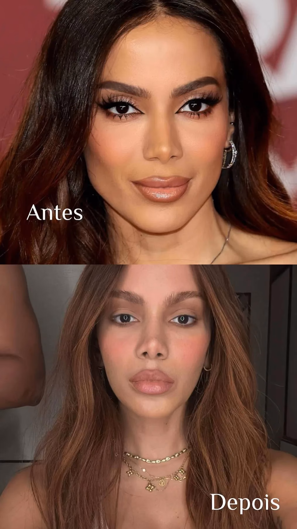 ¿Quién es el cirujano de Anitta?