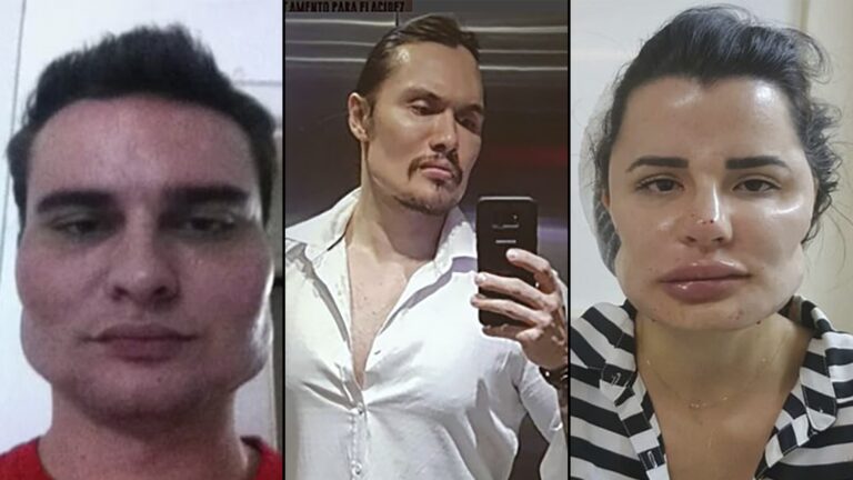 Cirugía Plástica Fallida: Causas y Soluciones