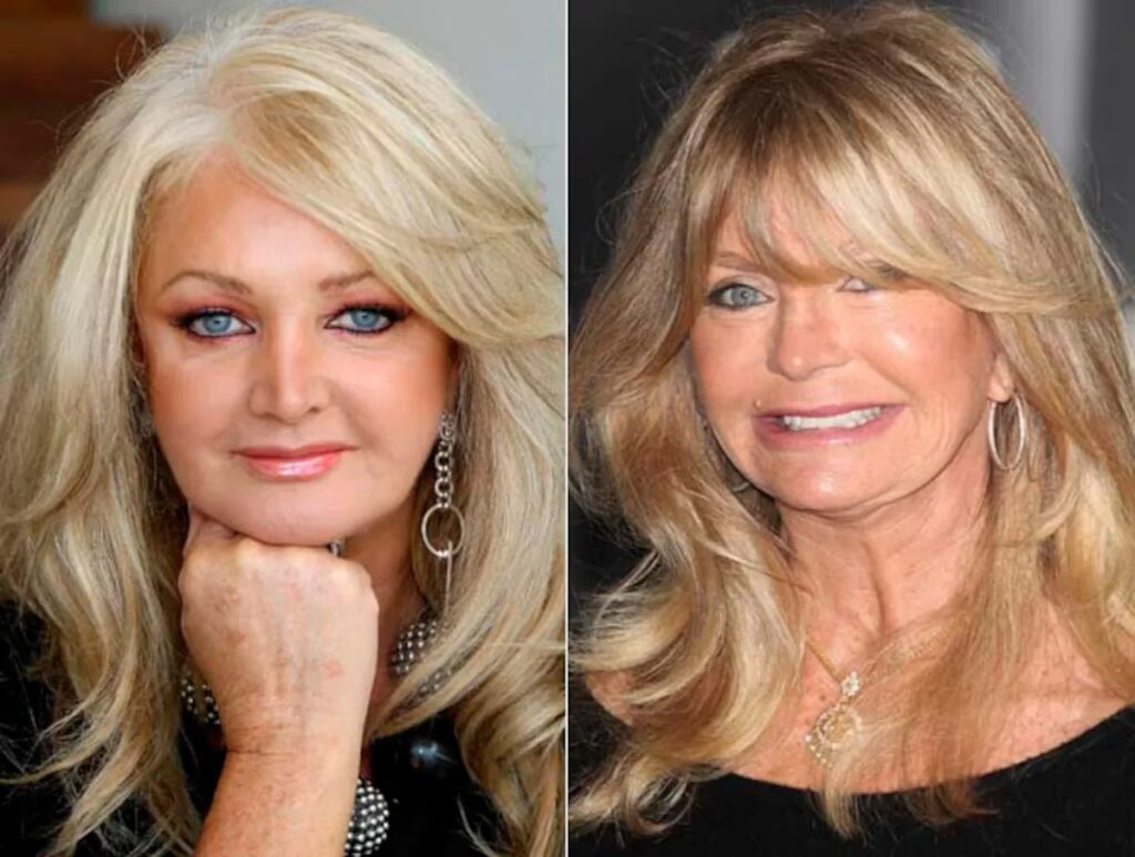 Bótox mal aplicado: Riesgos y cómo solucionarlo