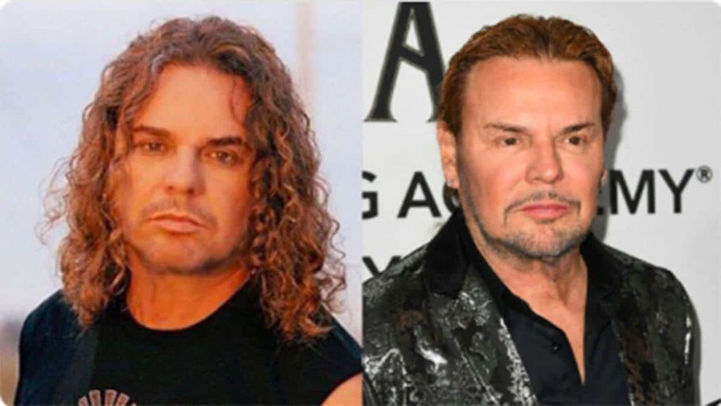 Fher de Maná: ¿Cirugía Plástica y Depresión?