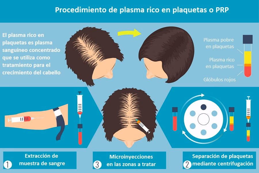 ¿Qué tan efectivo es el tratamiento con plasma para el cabello?