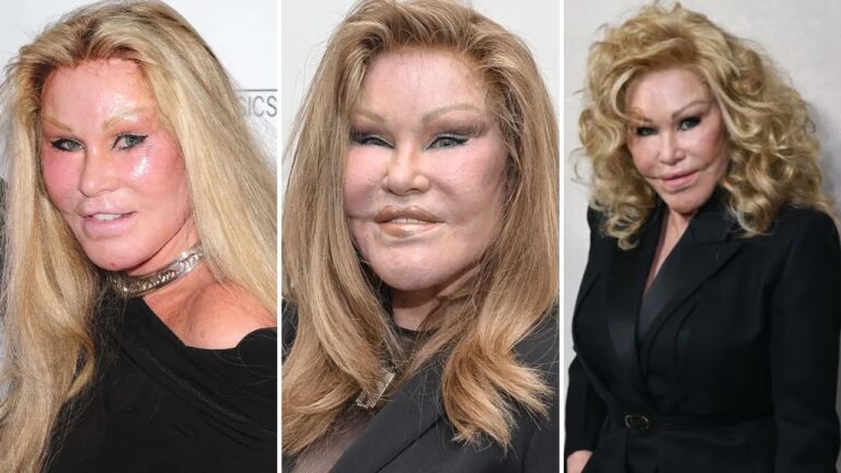 Tragedia Estética: Muerte por un Falso Cirujano