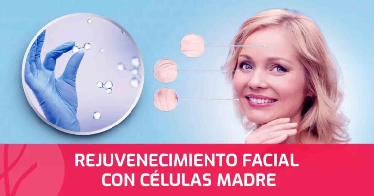 Costo de Células Madre Faciales: Guía de Precios