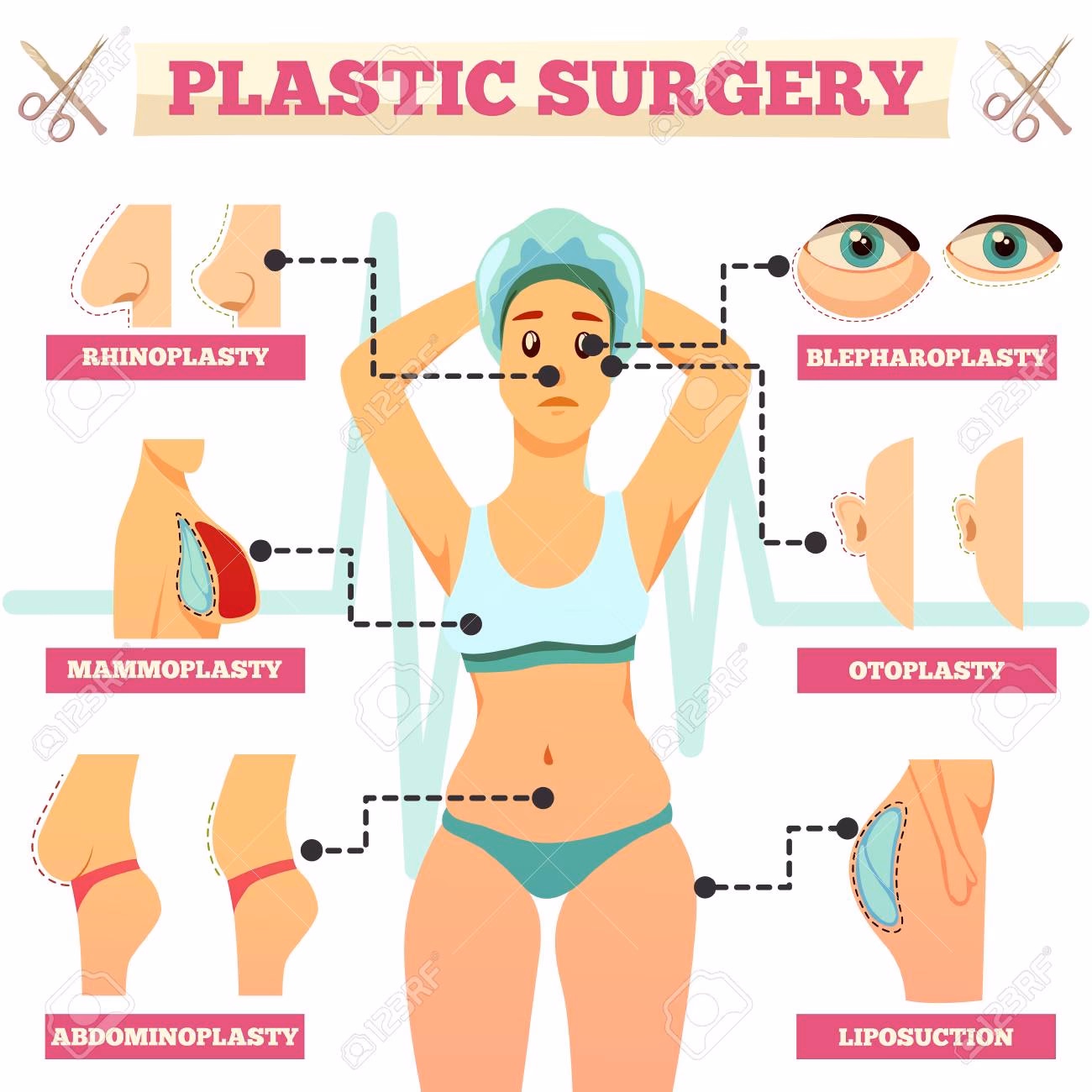 ¿Cómo se clasifican los tipos de cirugía?