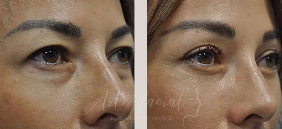 Guía para Elegir Cirujano Plástico en Costa Rica