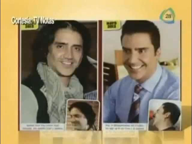 ¿Qué cirugías se ha hecho Alejandro Fernández?