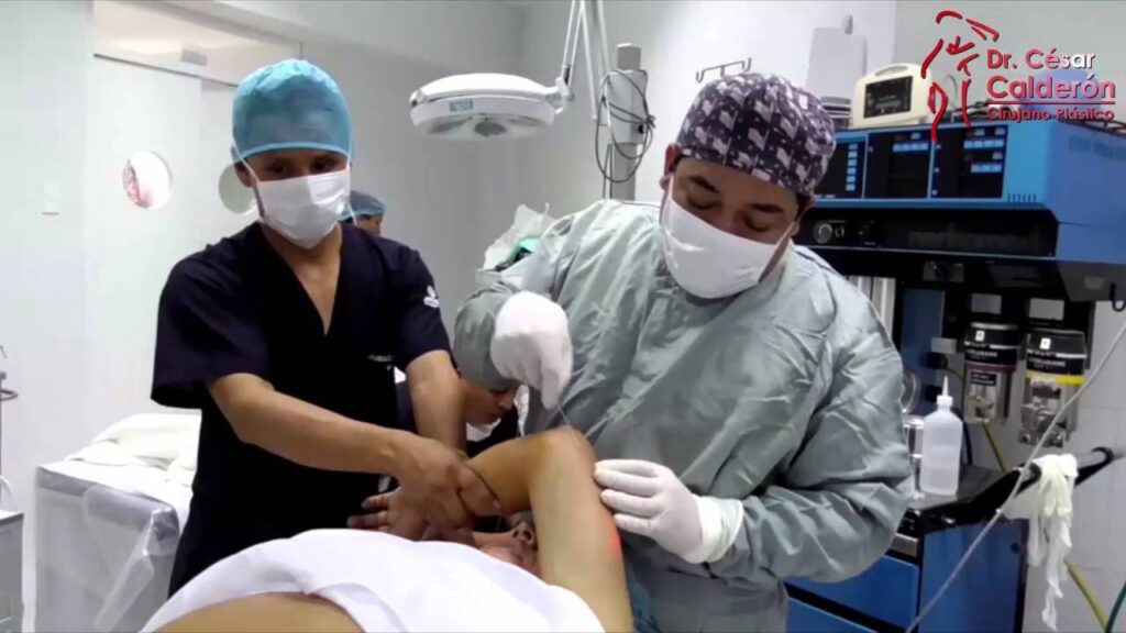 Lifting de Brazos: ¿Cirugía o Láser? Descúbrelo